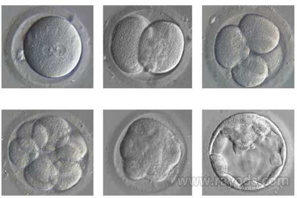 宣武借卵代生子价格_宣武’代生的价格_试管助孕过程中，囊胚培养有什么优势