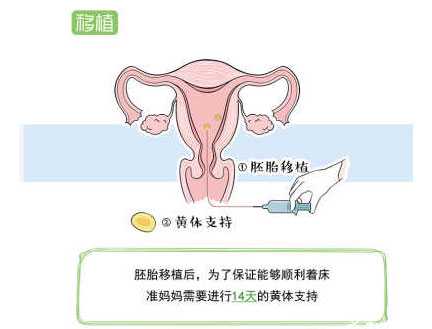 古塔区代孕做男孩价格_古塔区做代孕费用_泰国第三代试管婴儿具体流程怎么样