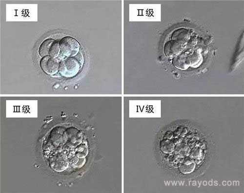 永仁县哪家代孕中心好_永仁县添一助孕代孕套餐_试管胚胎等级分类，二级胚胎