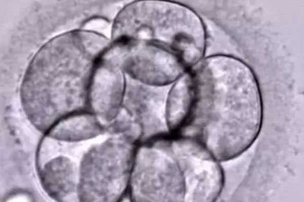 息烽县那有代孕的_息烽县正规代孕流程_泰国试管婴儿移植，如何挑选优质胚胎