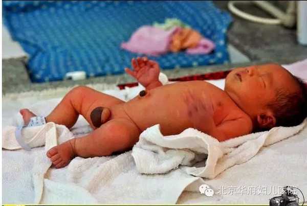 黑龙江专业供卵_试管婴儿想做就做？——年龄是道大坎儿！