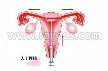 道　县求代孕机构的价格_不孕不育是男女双方问题，泰国试管备孕要双方努力